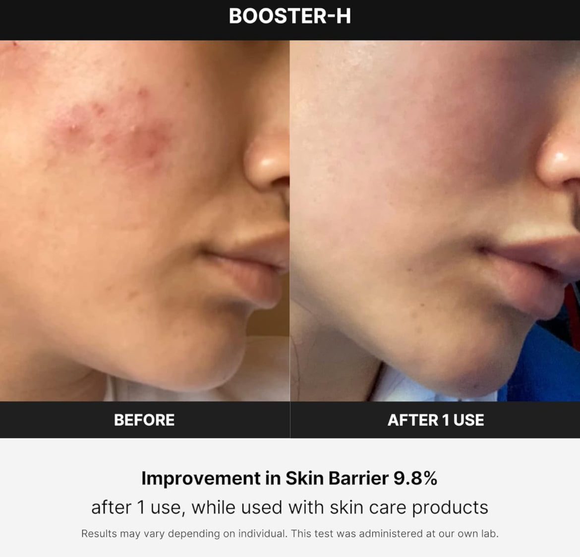 Medicube Age R Booster H Koreanisches Hautpflegegerät