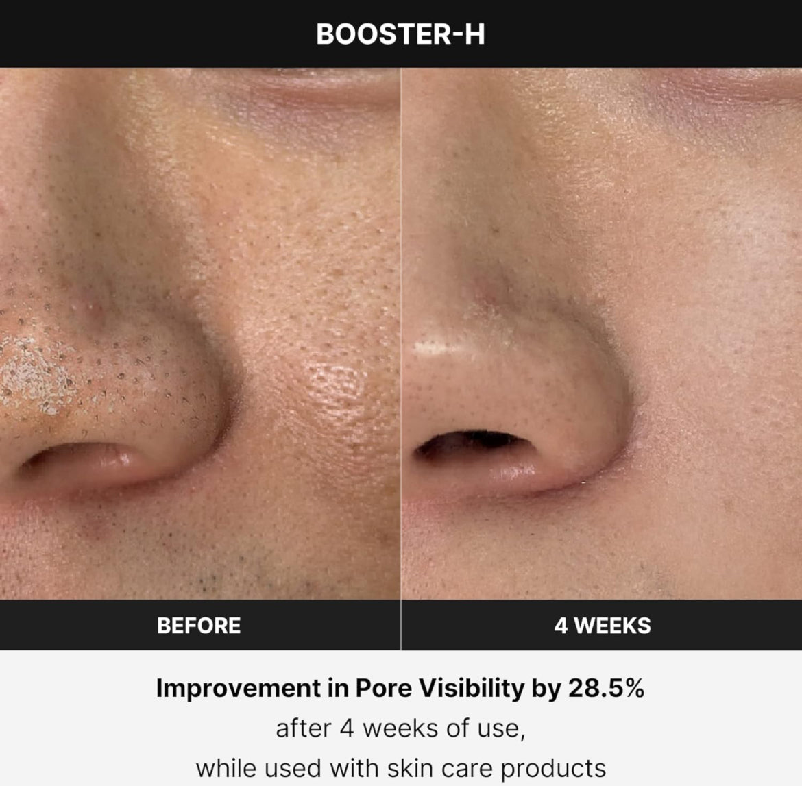 Medicube Age R Booster H Koreanisches Hautpflegegerät