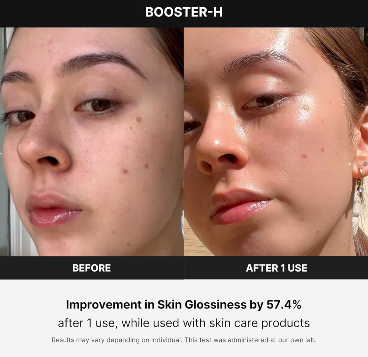 Medicube Age R Booster H Koreanisches Hautpflegegerät